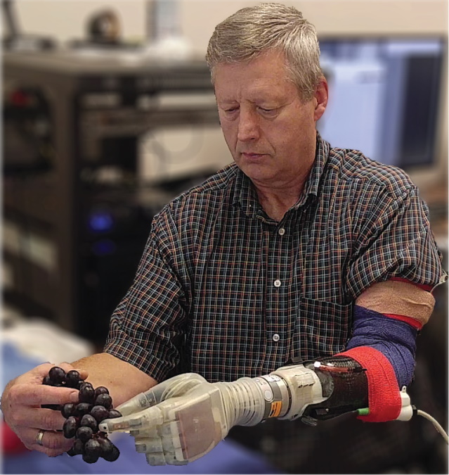 Robotická protéza Luka Skywalkera umožňuje ľuďom amputovať sa viac 2"width =" 639 "height =" 675