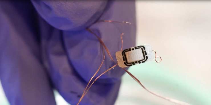 Seorang insinyur menanamkan chip RFID untuk membuka Tesla Model 3 dengan lengannya 1