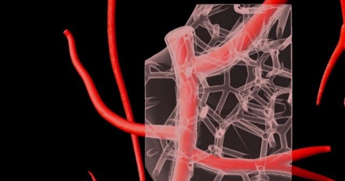 3D dicetak hati manusia berdasarkan kolagen