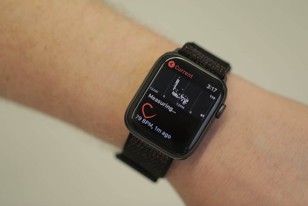 Apple Watch Adalah "Sepotong Teknologi Favorit Steve Wozniak Saat Ini"