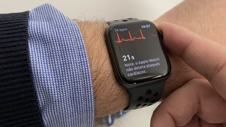 Gambar dari jam tangan pintar Apple melakukan EKG