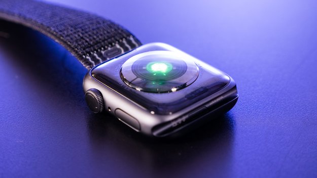Apple Watch Tidak berguna? Batas jam tangan pintar 1